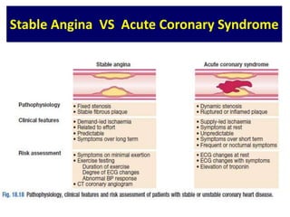 Stable Angina VS Acute Coronary Syndrome
 
