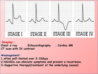 -Imaging:-
Chest x-ray . Echocardiography . Cardiac MR
CT scan with IV contrast
management:
1.often self-limited over 3-10days
2.NSAIDs can alleviate symptoms and prevent a recurrence.
3-Supportive therapy(treatment of the underlying causes)
 