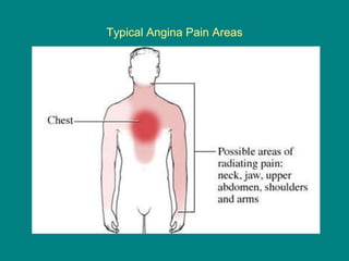 Typical Angina Pain Areas 