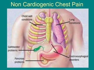 Non Cardiogenic Chest Pain 