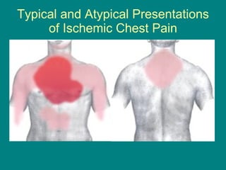 Chest pain 2009 ppt