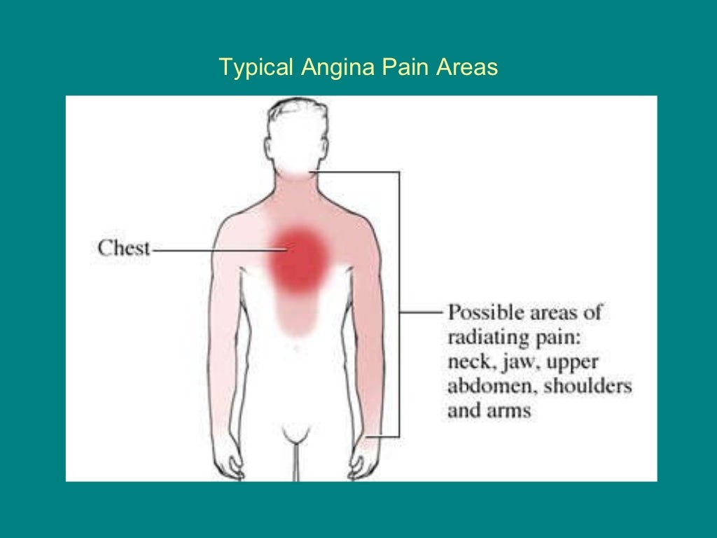 chest-pain-2009-ppt