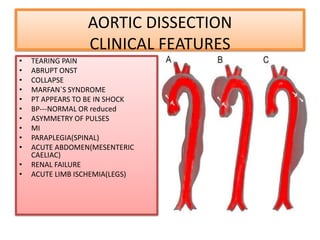 CENTRAL CHEST PAIN