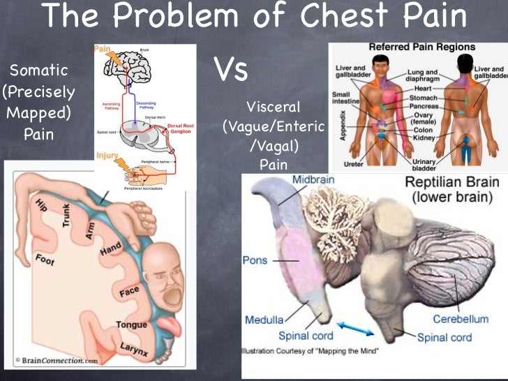 Differential Dx Chest Pain