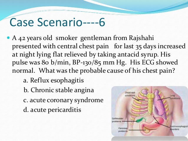 Acs case presentation picture