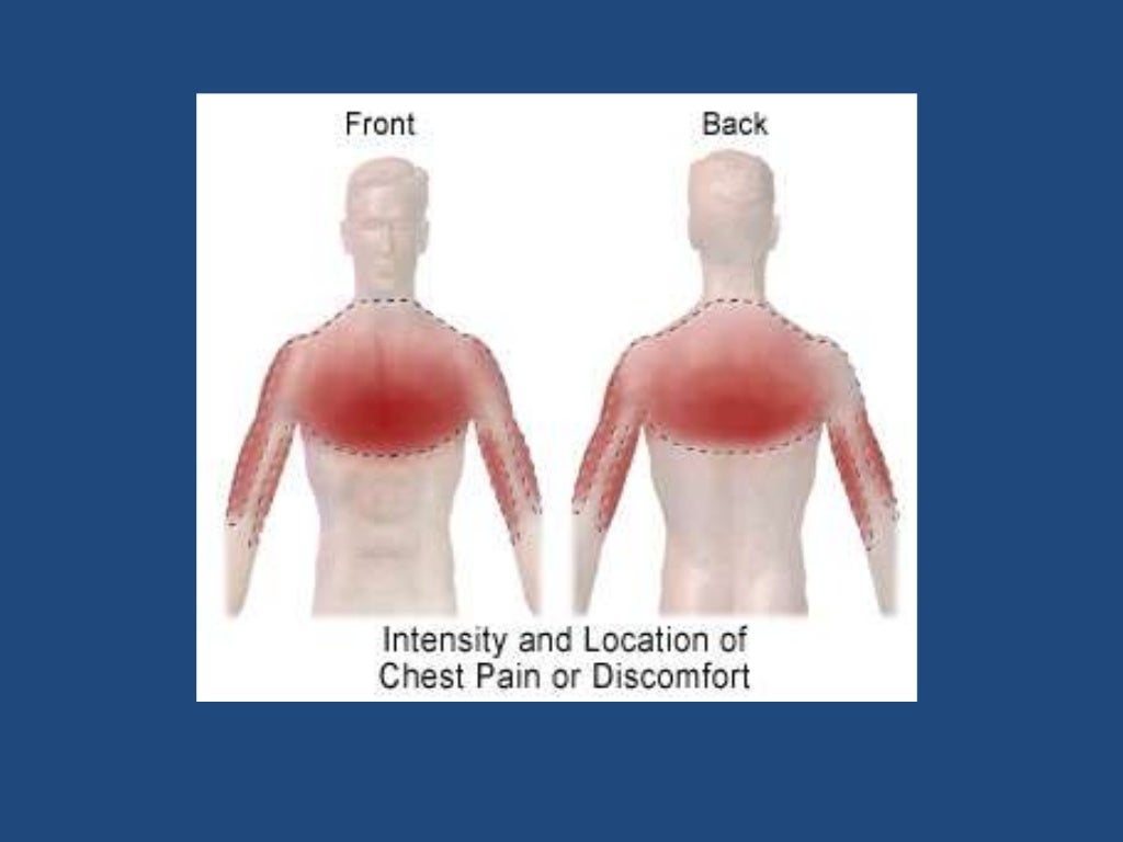 Chest pain presentation