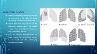 Chest xray pattern Part 1 Year 2 Class.pptx