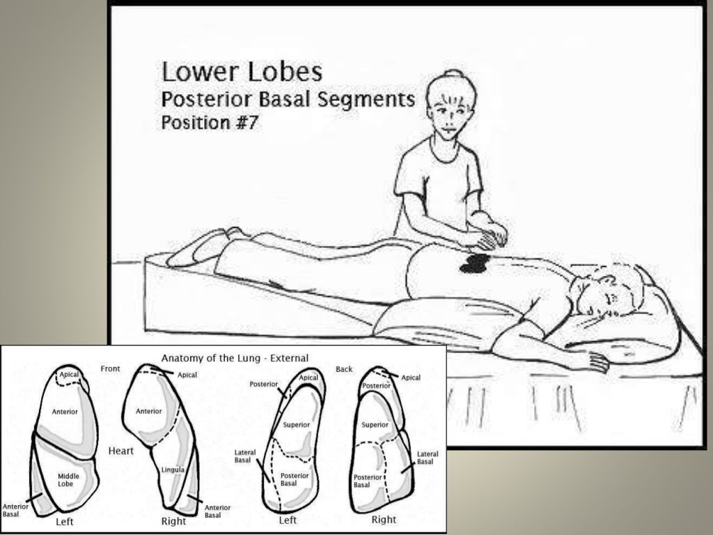 Chest Physiotherapy.. Dr.Padmesh