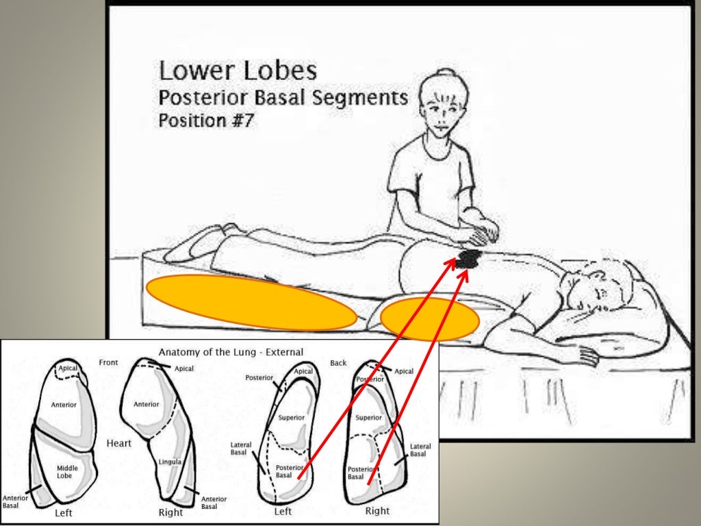 Chest Physiotherapy.. Dr.Padmesh