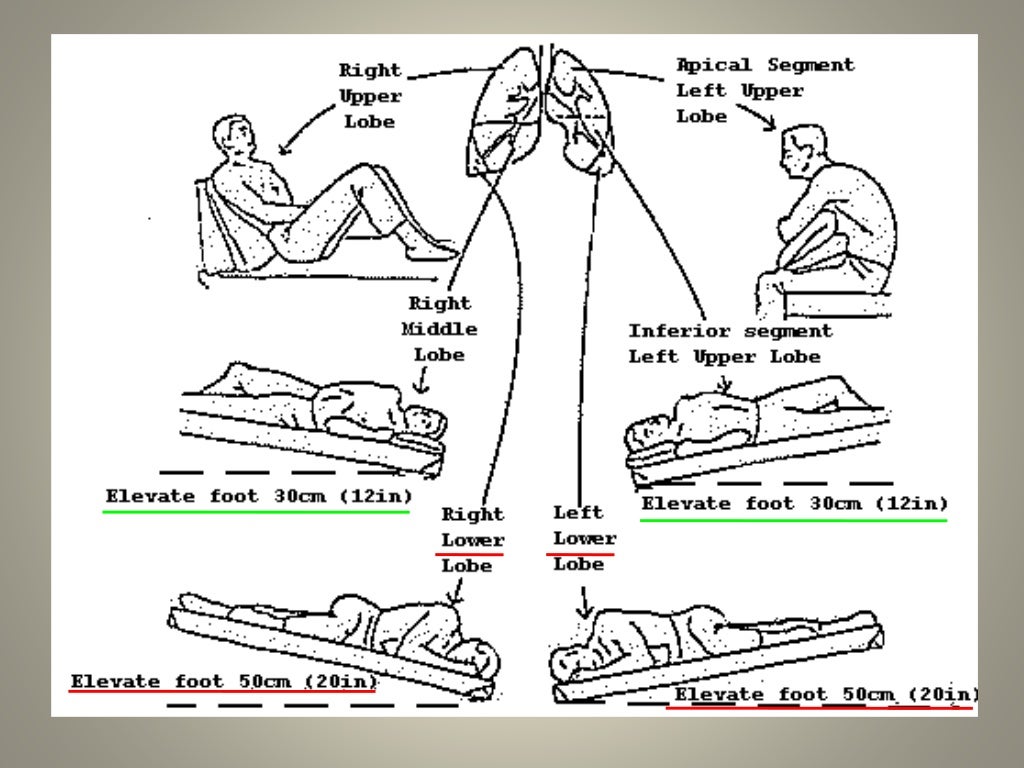 Chest Physiotherapy.. Dr.Padmesh