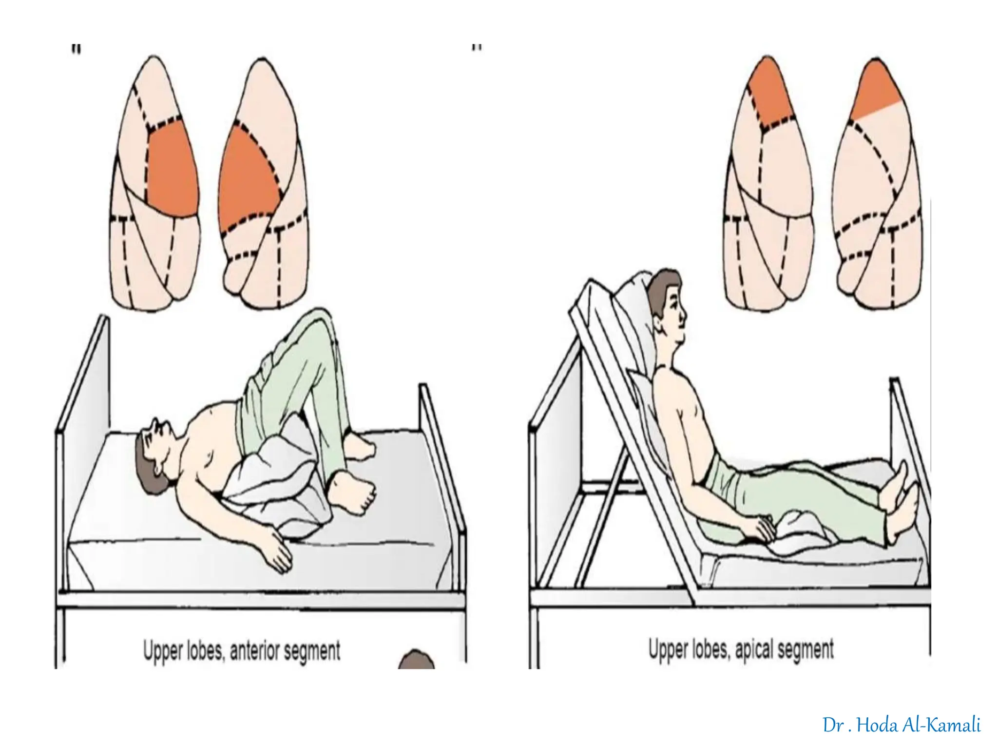 chest physiotherapy for nursing students.pptx