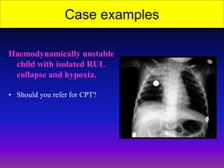 Chest Physiotherapy Dilemma.ppt