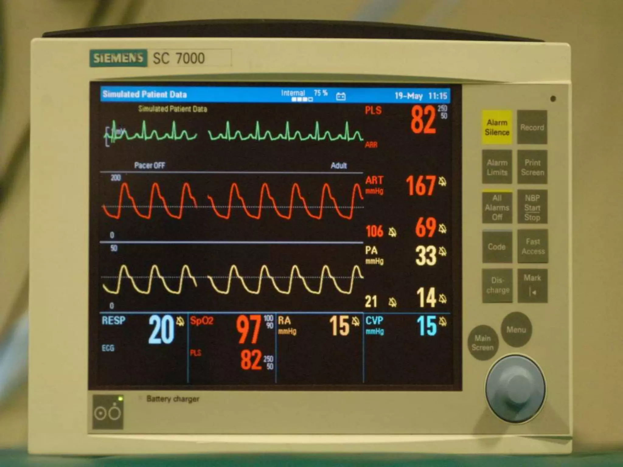 Chest Physiotherapy In Icu Pptx
