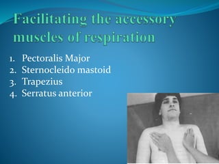 1. Pectoralis Major
2. Sternocleido mastoid
3. Trapezius
4. Serratus anterior
 