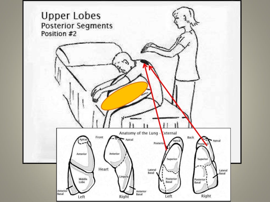 CHEST PHYSIOTHERAPY & POSTURAL DRAINAGE