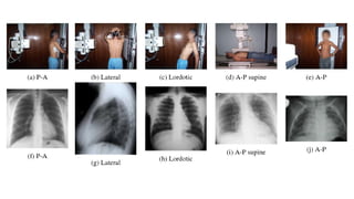 CHEST RADIOGRAPH .pptx