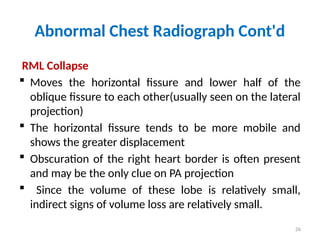 Rml Collapse Radiograph Chest Radiograph Course for medicine c-one and c-two students .pptx