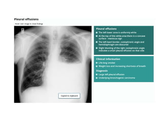 Chest Radiograph Course for medicine c-one and c-two students .pptx