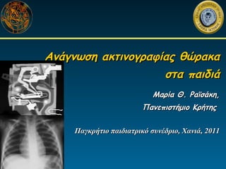 Ανάγνωση ακτινογραφίας θώρακα
                    στα παιδιά
                            Μαρία Θ. Ραϊσάκη,
                         Πανεπιστήμιο Κρήτης


     Παγκρήτιο παιδιατρικό συνέδριο, Χανιά, 2011
 