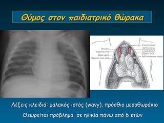 Θύμος στον παιδιατρικό θώρακα




Λέξεις κλειδιά: μαλακός ιστός (wavy), πρόσθιο μεσοθωράκιο
    Θεωρείται πρόβλημα: σε ηλικία πάνω από 6 ετών
 