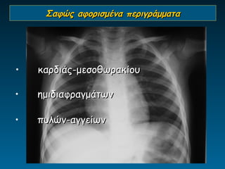 Σαφώς αφορισμένα περιγράμματα




•   καρδιάς-μεσοθωρακίου

•   ημιδιαφραγμάτων

•   πυλών-αγγείων
 