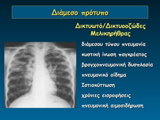 Διάμεσο πρότυπο
      Δικτυωτό/Δικτυοοζώδες
           Μελικηρήθρας
       διάμεσου τύπου πνευμονία
       κυστική ίνωση παγκρέατος
       βρογχοπνευμονική δυσπλασία
       πνευμονικό οίδημα
       Ιστιοκύττωση
       χρόνιες εισροφήσεις
       πνευμονική αιμοσιδήρωση
 