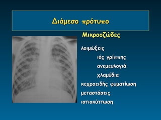 Διάμεσο πρότυπο
       Μικροοζώδες

       λοιμώξεις
             ιός γρίππης
             ανεμευλογιά
             χλαμύδια
       κεχροειδής φυματίωση
       μεταστάσεις
       ιστιοκύττωση
 