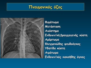 Πνευμονικός όζος


       Φυμάτωμα
       Μετάσταση
       Απόστημα
       Ενδοπν/κή βρογχογενής κύστη
       Αμάρτωμα
       Φλεγμονώδης ψευδοόγκος
       Υδατίδα κύστη
       Αιμάτωμα
       Ενδοπν/κός κακοήθης όγκος
 