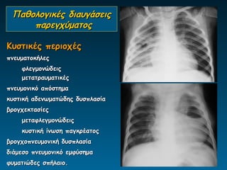 Παθολογικές διαυγάσεις
     παρεγχύματος

Κυστικές περιοχές
πνευματοκήλες
    φλεγμονώδεις
    μετατραυματικές
πνευμονικό απόστημα
κυστική αδενωματώδης δυσπλασία
βρογχεκτασίες
    μεταφλεγμονώδεις
    κυστική ίνωση παγκρέατος
βρογχοπνευμονική δυσπλασία
διάμεσο πνευμονικό εμφύσημα
φυματιώδες σπήλαιο.
 