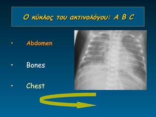 Ο κύκλος του ακτινολόγου: A B C


•   Abdomen


•   Bones


•   Chest
 