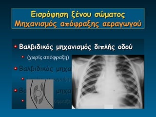Εισρόφηση ξένου σώματος
Μηχανισμός απόφραξης αεραγωγού

 Βαλβιδικός μηχανισμός διπλής οδού
   (χωρίς απόφραξη)

 Βαλβιδικός μηχανισμός μονής οδού
   (ατελής απόφραξη=>αποφρακτικό εμφύσημα)

 Βαλβιδικός μηχανισμός καμίας οδού
   (πλήρης απόφραξη=>ατελεκτασία)
 