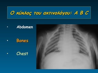 Ο κύκλος του ακτινολόγου: A B C

•     Abdomen


•     Bones


•     Chest
 