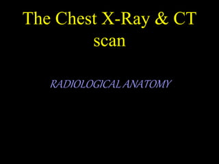The Chest X-Ray & CT
scan
RADIOLOGICAL ANATOMY