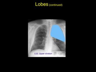 Lobes(continued)
• Left upper lobe - upper division: