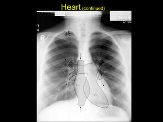 Heart(continued)