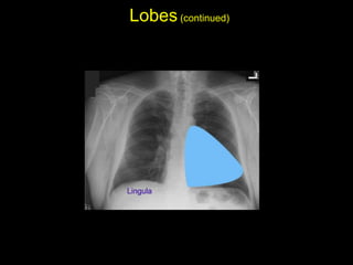 Lobes(continued)
• Lingula:
