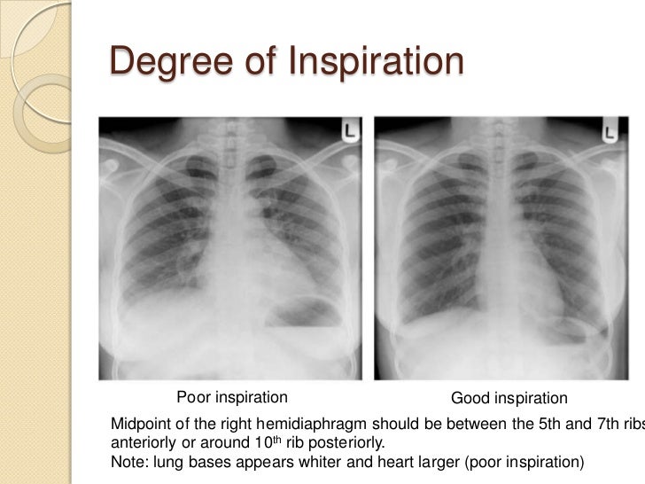Chest Radiography Introduction chest-radiography-introduction