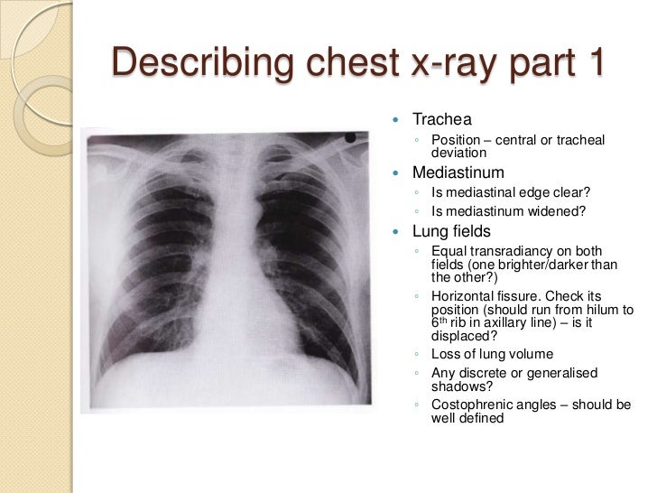Chest radiography introduction