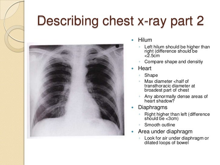 Chest radiography introduction