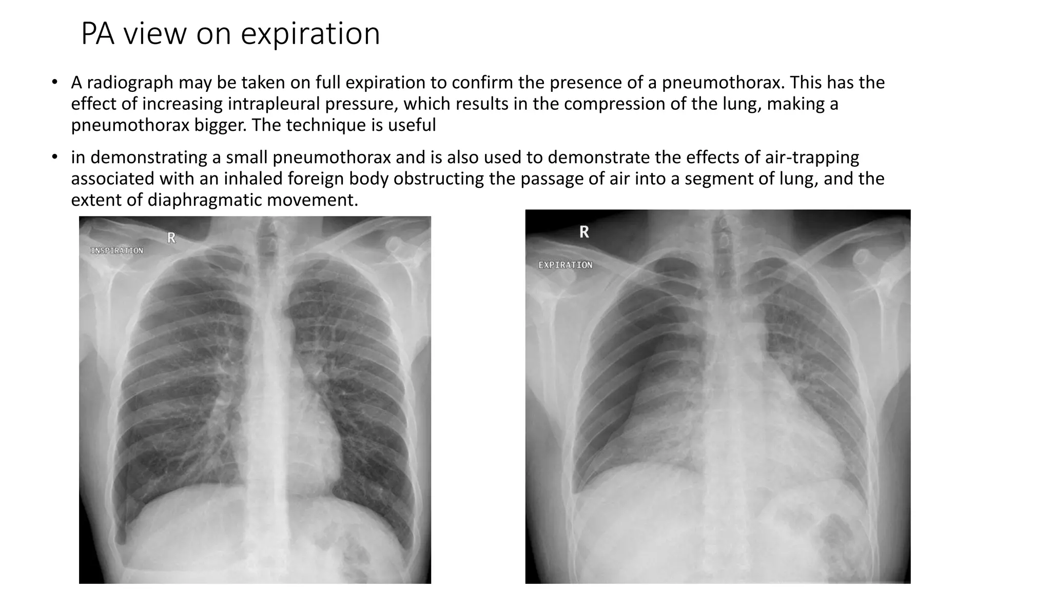 Chest radiography positioning and Technique.pptx