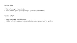 Rotation to left
• Heart size maybe overestimated
• aortic arch may appear spuriously enlarged, hyperlucency of the left lung
Rotation to Right
• Heart size maybe underestimated
• rotation to the right may cause: pseudo-mediastinal mass, hyperlucency of the right lung
 