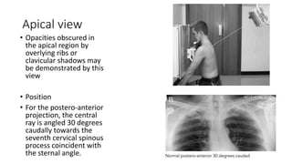 Chest radiography positioning and Technique.pptx