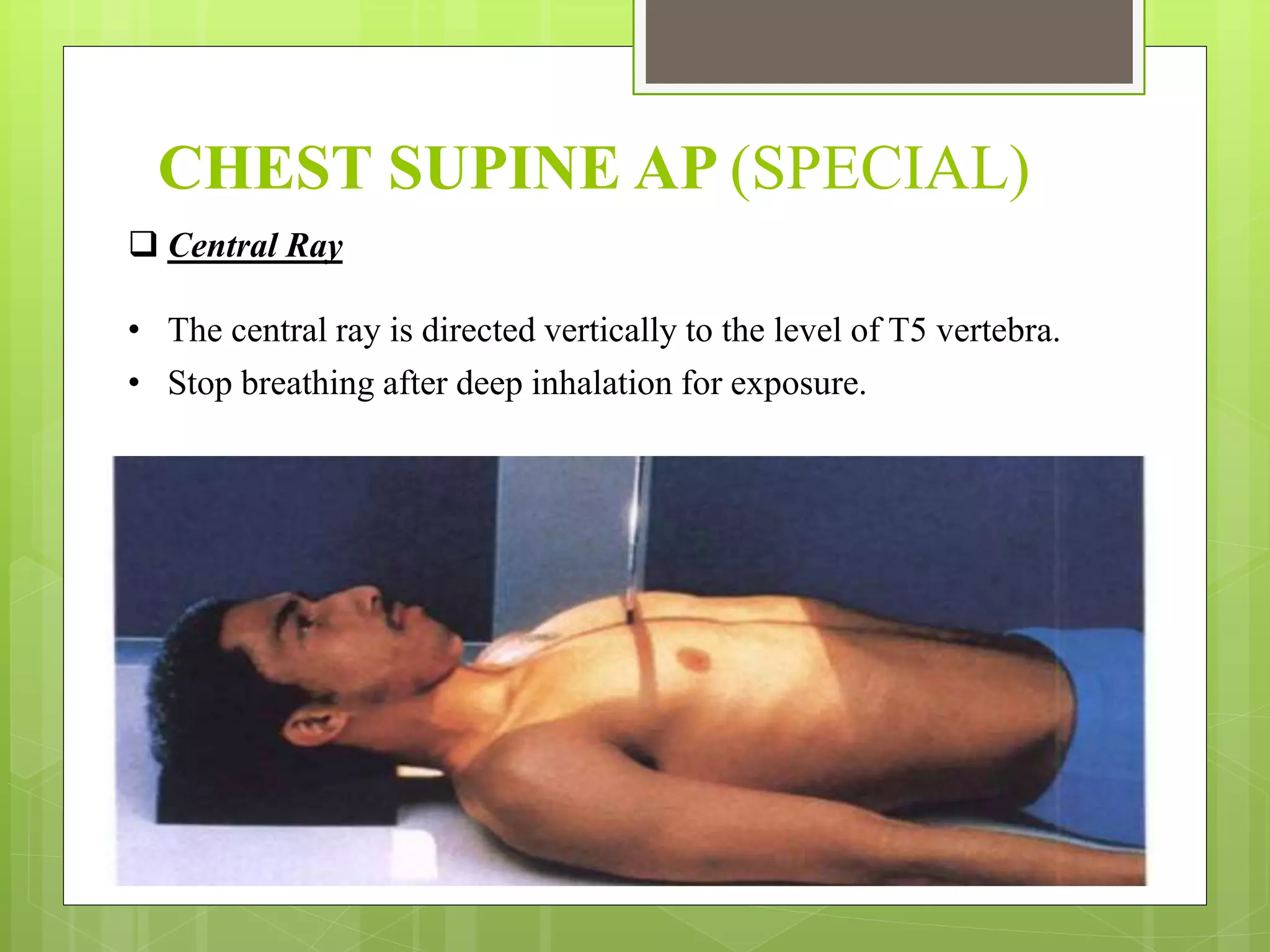 CHEST RADIOGRAPHY - Routine & special radiographs | PPTX