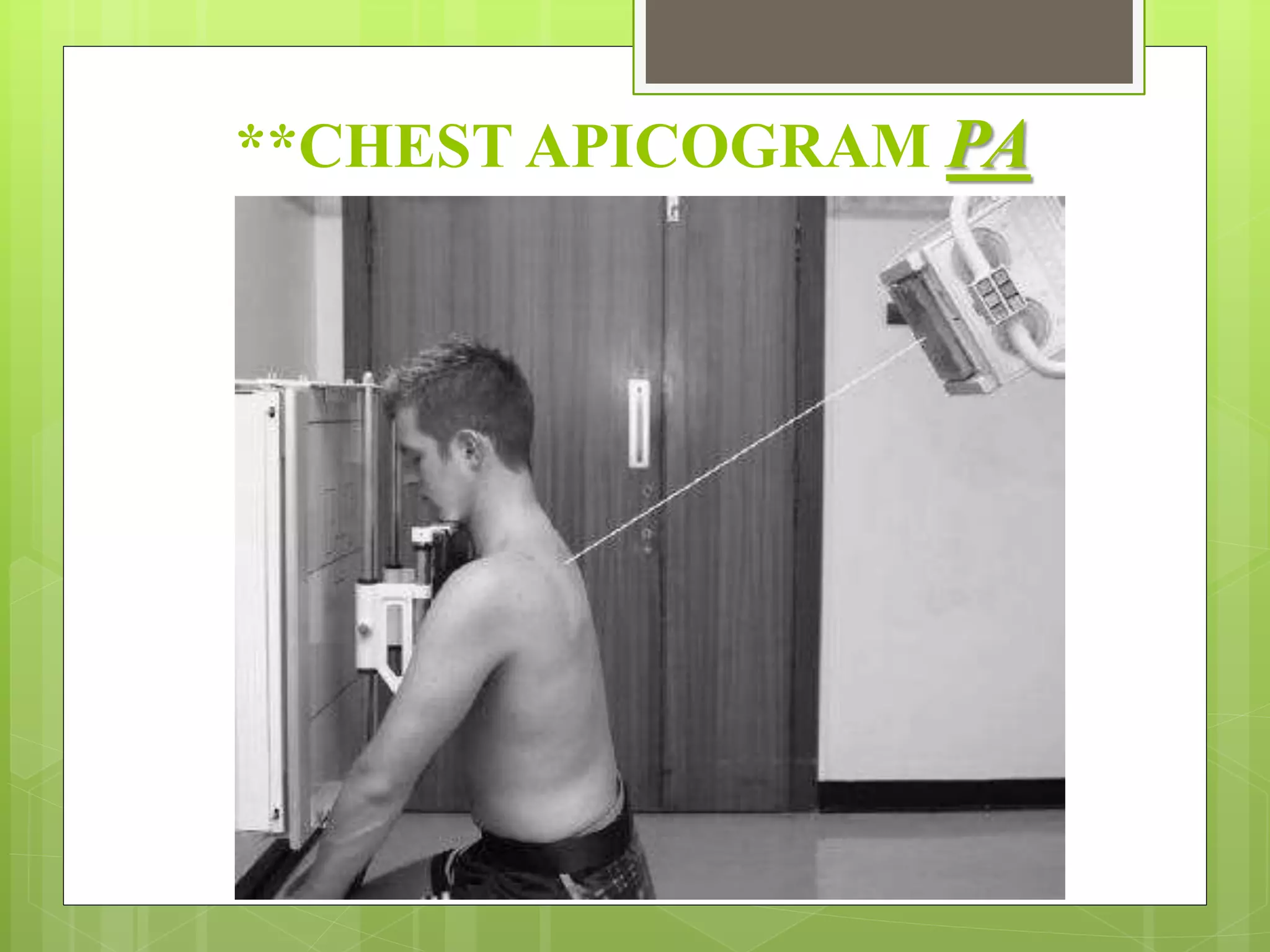 CHEST RADIOGRAPHY - Routine & special radiographs | PPTX