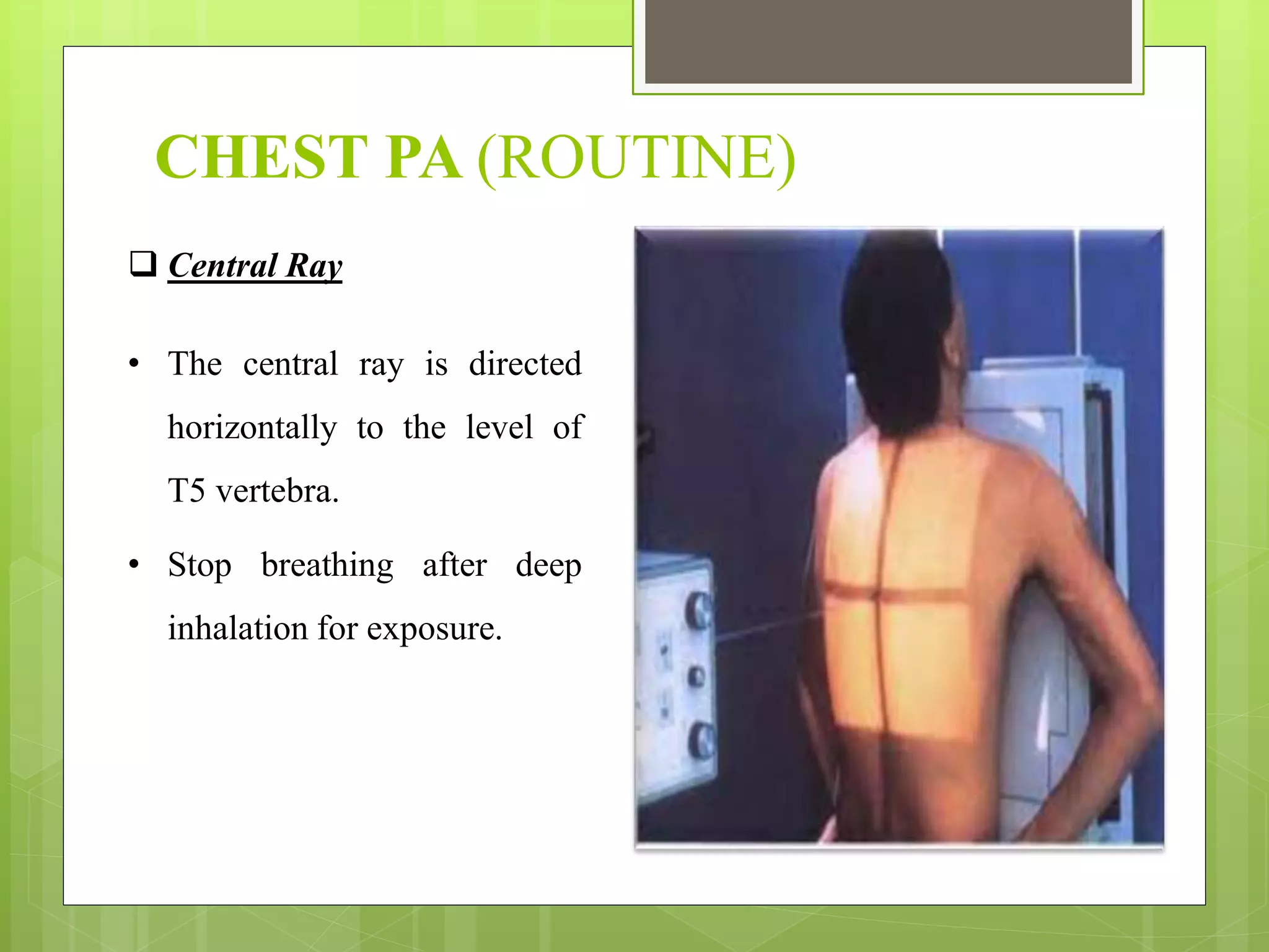 CHEST RADIOGRAPHY - Routine & special radiographs | PPTX