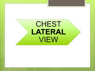 CHEST
LATERAL
VIEW
 