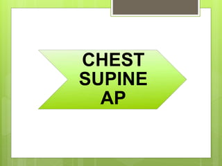 CHEST
SUPINE
AP
 