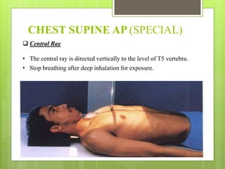 CHEST SUPINE AP (SPECIAL)
 Central Ray
• The central ray is directed vertically to the level of T5 vertebra.
• Stop breathing after deep inhalation for exposure.
 
