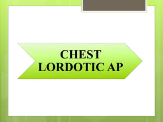 CHEST
LORDOTIC AP
 