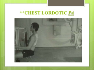 **CHEST LORDOTIC PA
 
